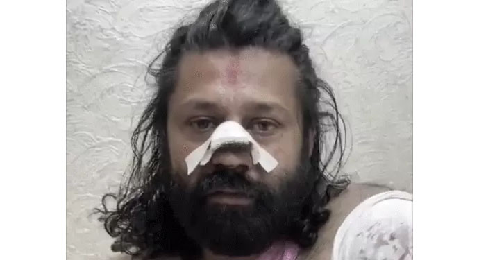 प्रयागराज जा रहे आशुतोष ब्रह्मचारी पर ट्रेन में जानलेवा हमला: शंकराचार्य पर FIR कराने के बाद 'नाक काटने' की कोशिश