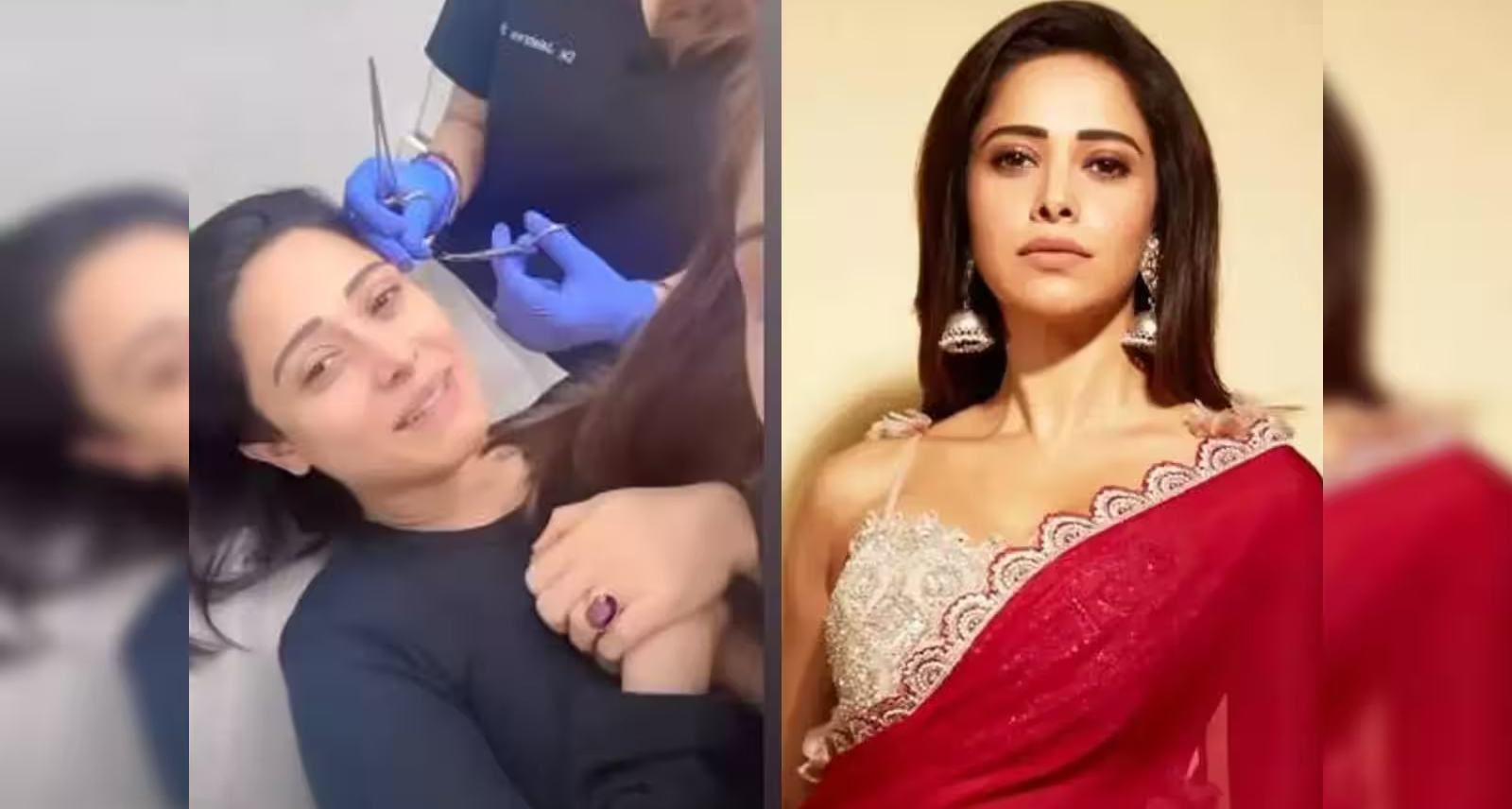 बाली में दर्दनाक हादसे का शिकार हुईं बॉलीवुड एक्ट्रेस नुसरत भरूचा: अस्पताल में भर्ती